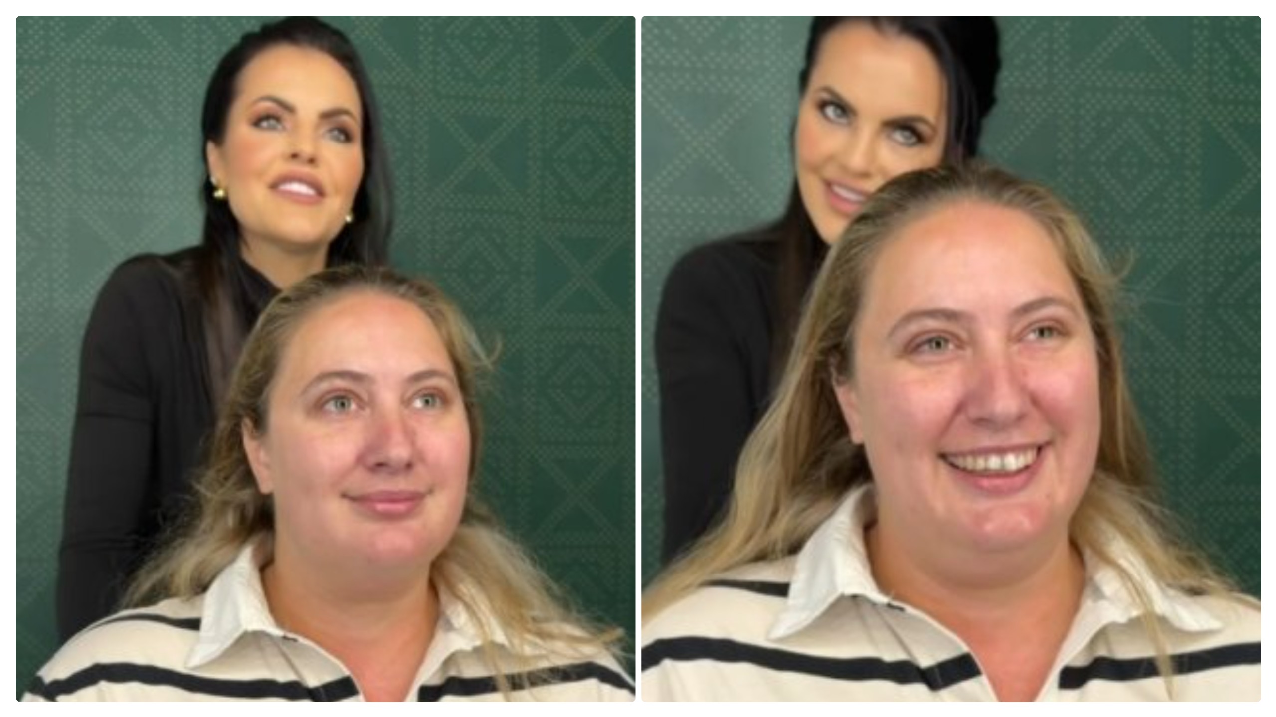 Everyone Was Looking at Her Face… Then the Stylist Made ONE Unexpected Change!